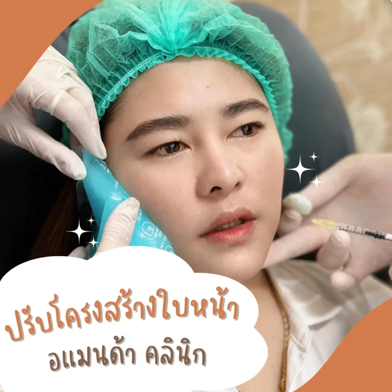ปรับโครงสร้างใบหน้า (Face Shape Adjustment)