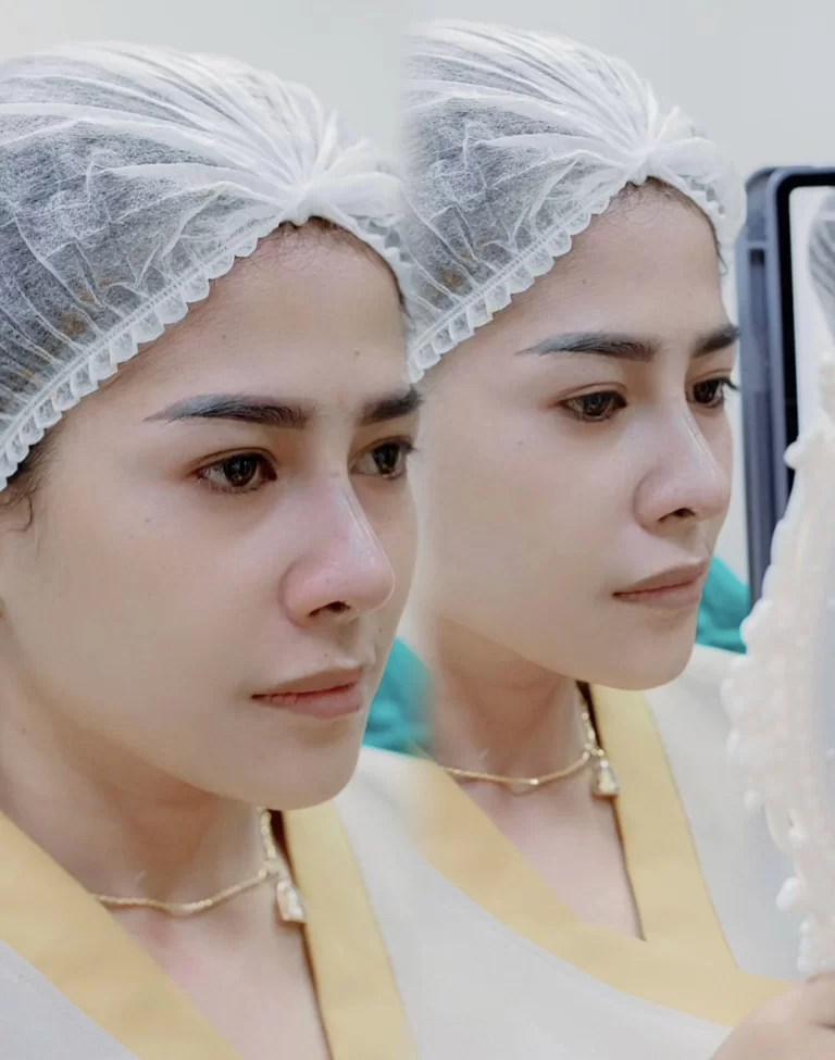 เสริมจมูกเพื่อความสวยงาม: วิธีปรับรูปร่างใบหน้าให้สมดุลและสมส่วน