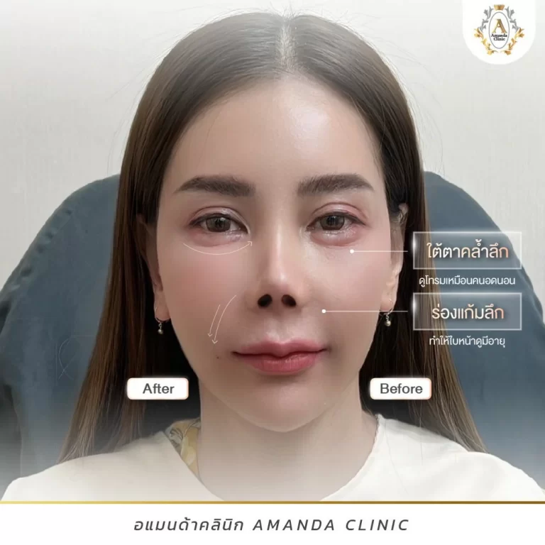 ปรับโครงหน้า คำแนะนำสำหรับการตัดสินใจที่ถูกต้อง