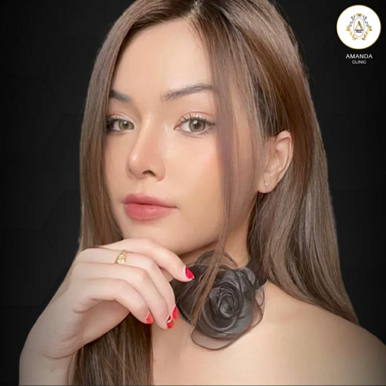 การทำจมูกแบบโอเพ่น: ความสวยที่เพิ่มมุมมองและความเสนอ