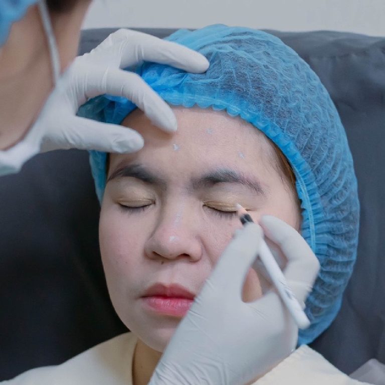โบท็อกใต้ตา โบท็อก
